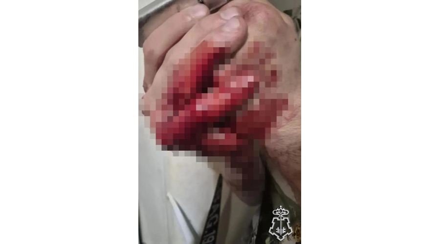 В Петербурге наряд Росгвардии задержал жительницу коммунальной квартиры, ударившую ножом мужчину в ходе бытового конфликта